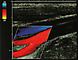 Karotis-Ultraschall: Normalbefund (Color-Mode)